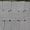 Тротуарная плитка "Римский камень" серая 40 - 60мм. - <ro>Изображение</ro><ru>Изображение</ru> #4, <ru>Объявление</ru> #1708792
