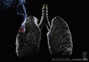  Курение может привести к раку.Поможем бросить курить за1 сеанс. - <ro>Изображение</ro><ru>Изображение</ru> #2, <ru>Объявление</ru> #929355
